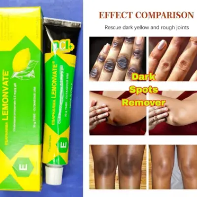 Esapharma Lemonvate Cream 30gm